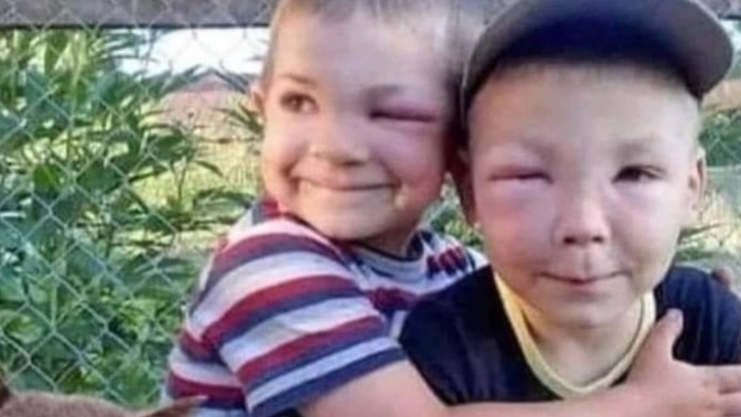 Öğlen aldığımız bi habere göre arı kovanıdan bal çalmaya çalışan üçlü yakalanmış🐝🐝 kovanı olan arkadaşlar dikkat ediyor mu buna?