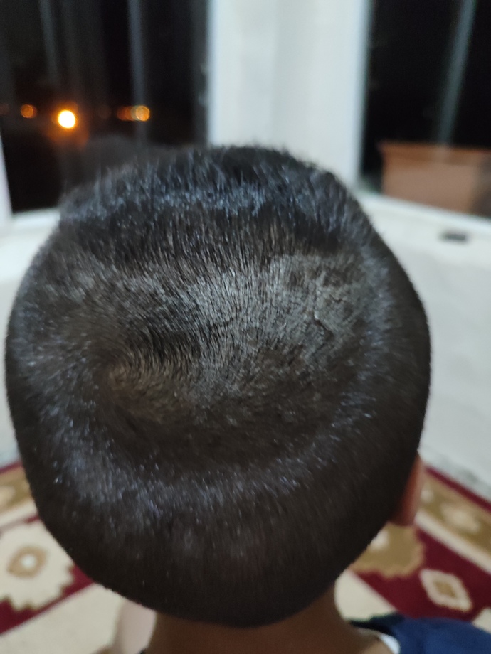 Kafadaki egzamaya ne iyi gelir?