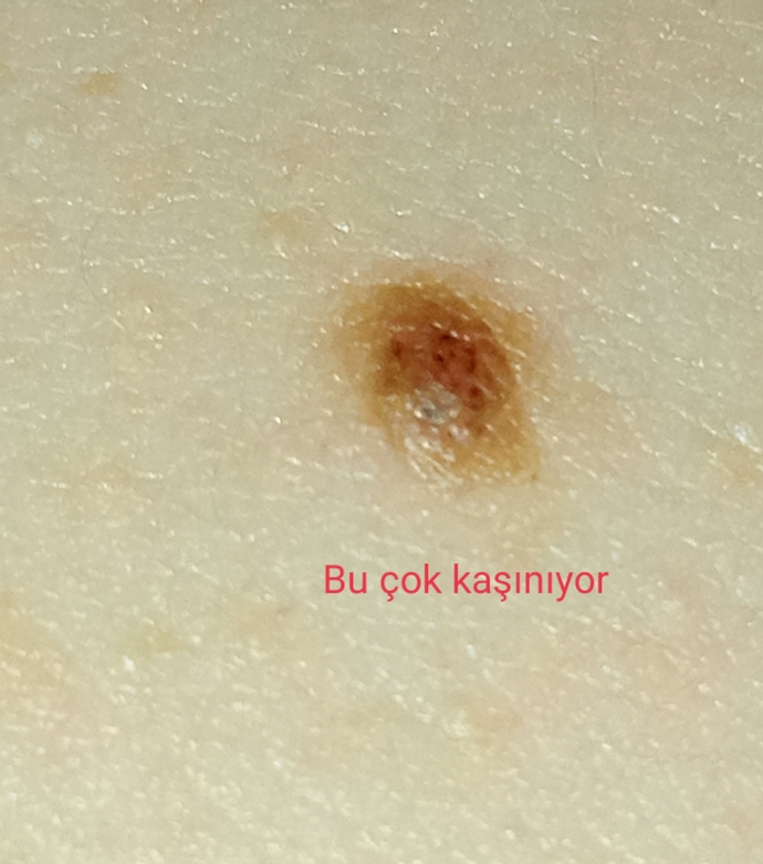 Zoom yaparak çekmiştim meraktan 😂
