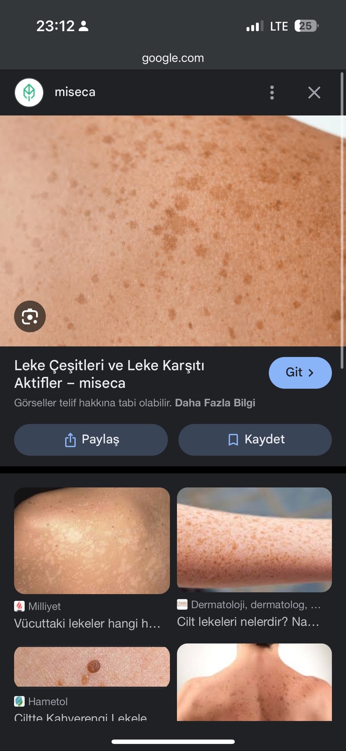 Ciltte böyle lekeler gitmez mi?