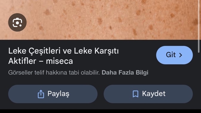 Ciltte böyle lekeler gitmez mi?
