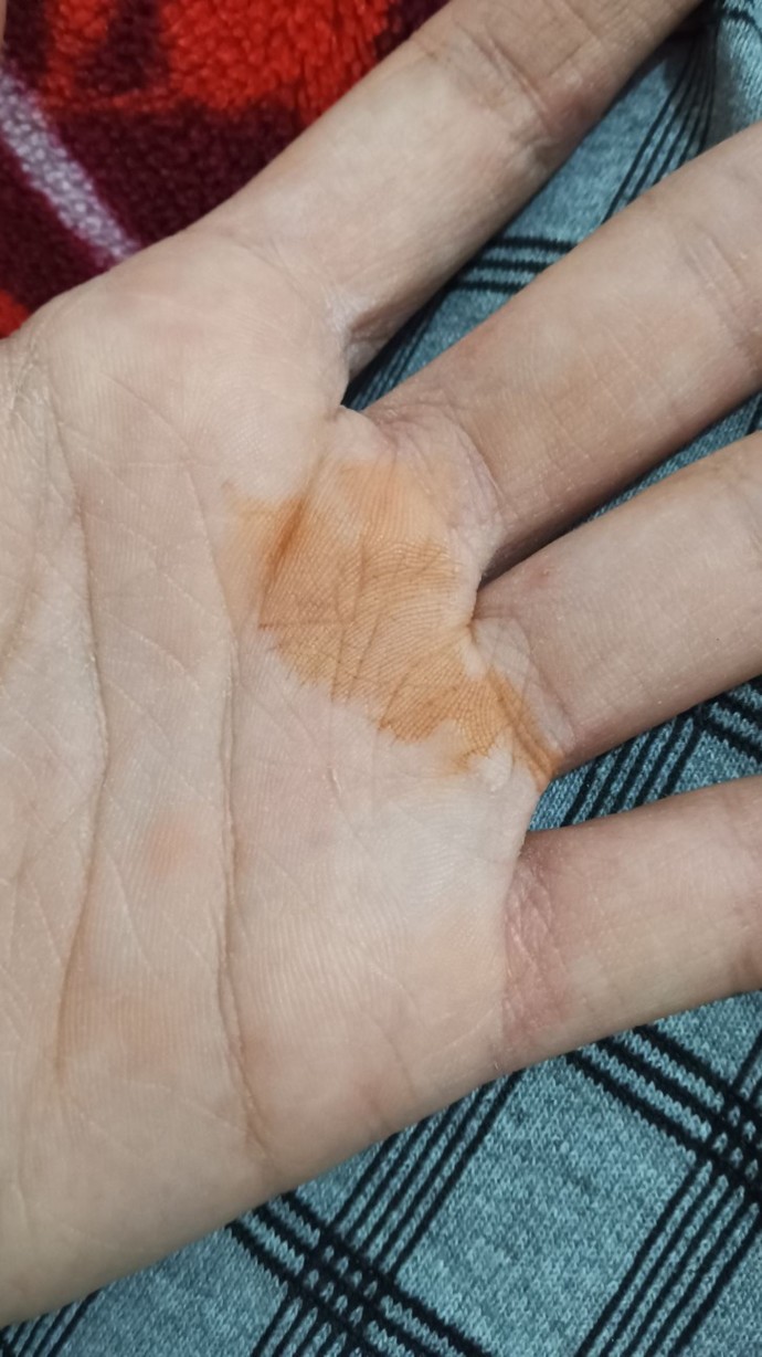 Bunların açıklaması ne?