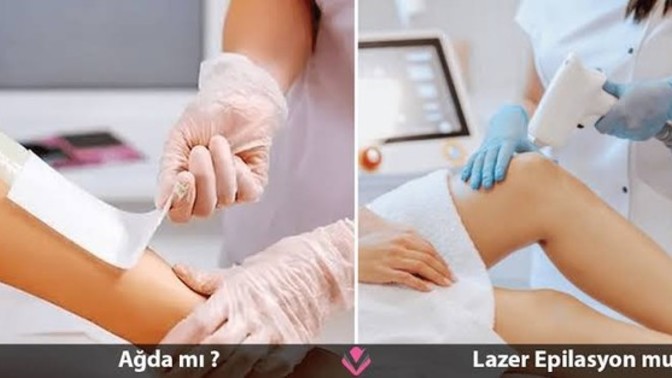 Ağda mı, lazer mi?