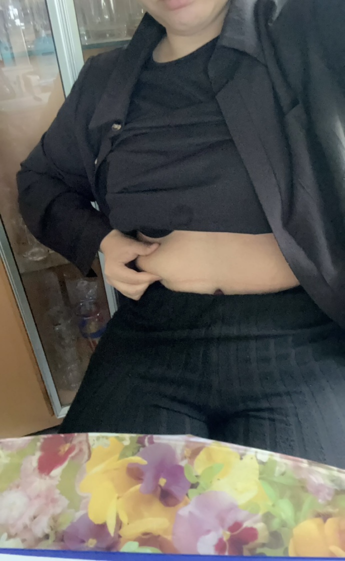 Ya ben oturunca burada bor kat oluşuyor? Bu normal mi? Şişko gibi duruyom?