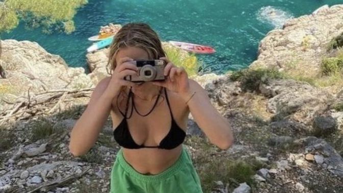 Bikini giymeye utanıyorum, çatlaklarım var. Ne yapmalıyım?