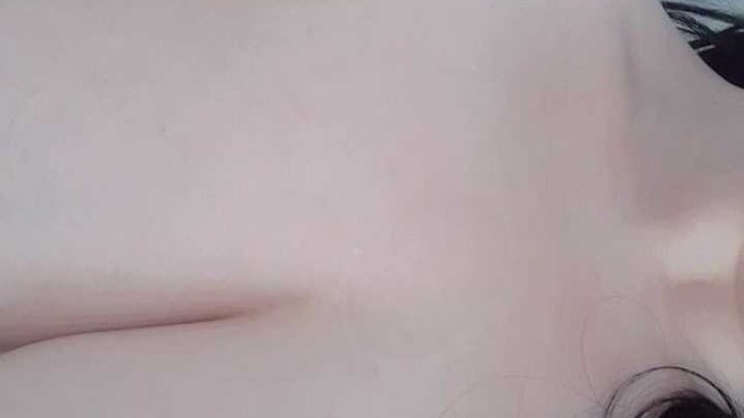 Göğüslerim çok mu büyük? küçültme ameliyatı olmalı mıyım?