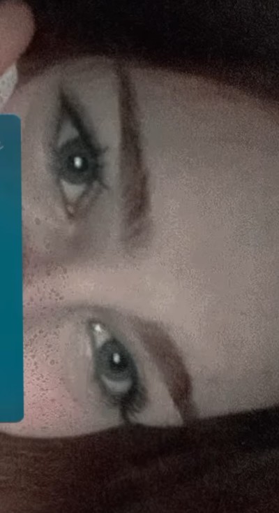 Bu göz lens mi?