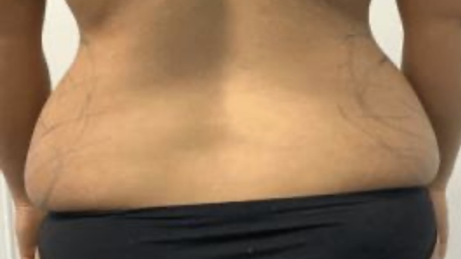 Burdan nasıl kilo verecem ya bu kadar belirgin değil bende ama 10 gündür yediklerime dikkat ediyorum tik yok hala oralarim taş gib?
