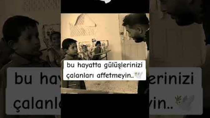 Gülüşlerinizi çalanları hangi durumda affedersiniz? Affeder misiniz?