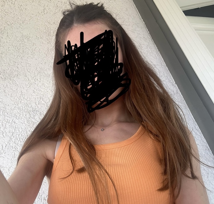 Saçlarım seyrek mi duruyor?