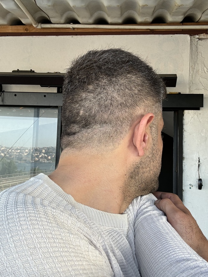 Berber ensemi güzel kesmişmi sizce?