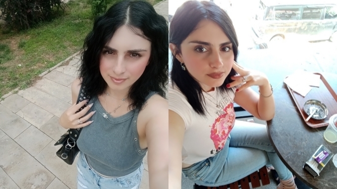 Boyum 1.60 ama 49 kiloya göre kilolu görünmüyor muyum?
