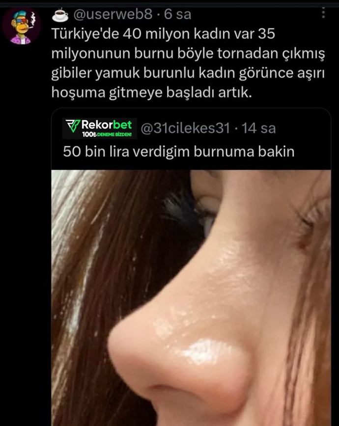 Burnu güzel olmayan var mı 🙄 ?