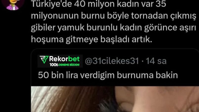 Burnu güzel olmayan var mı 🙄 ?