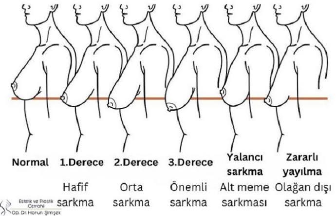 Durum ne
