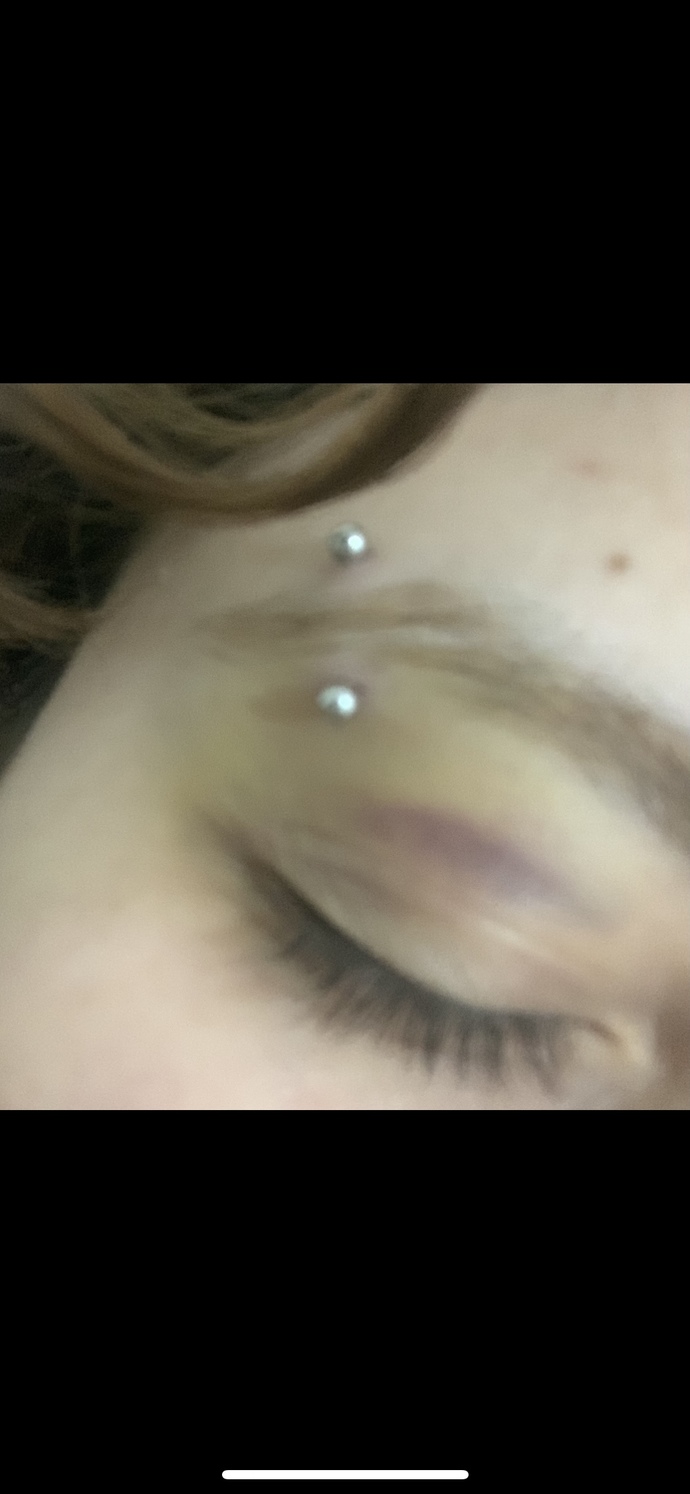 Kaş Piercinginin böyle olması normal mi?