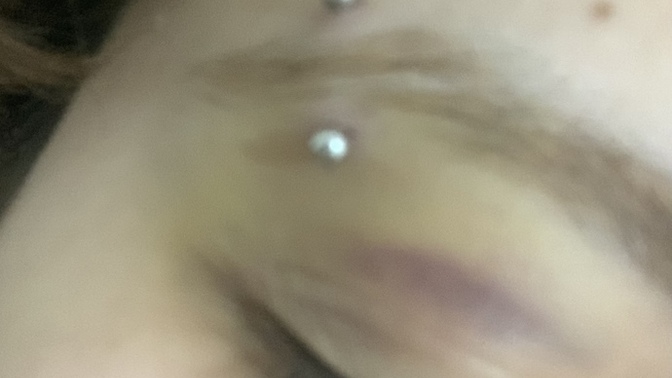 Kaş Piercinginin böyle olması normal mi?