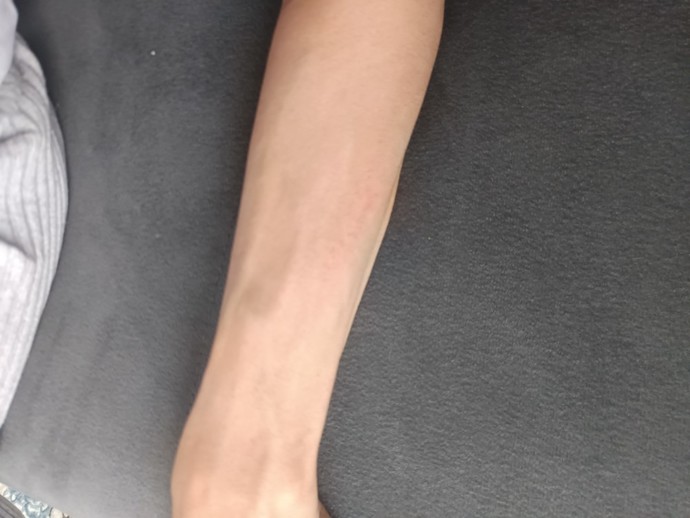 Bu uyuz olabilir mi yoksa başka bir şey mi?