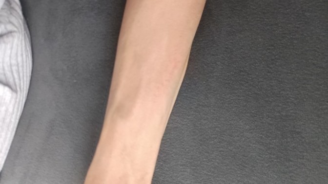 Bu uyuz olabilir mi yoksa başka bir şey mi?