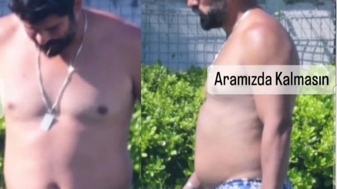 35 yaş üstü her erkek göbeklenmek kaderi mi Burak Özçivit gibi?