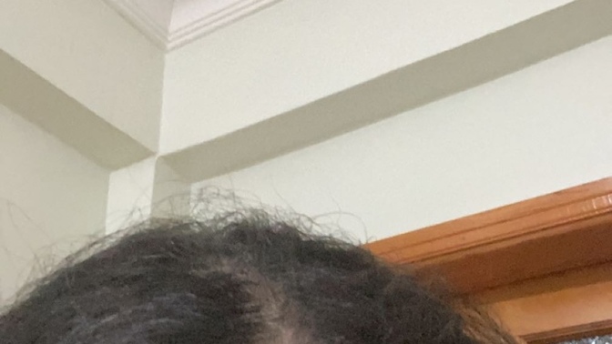Saçlarda niye böyle açılma olur?
