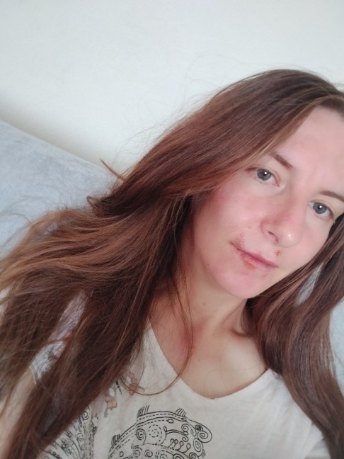 Selam uçukçıktı nasıl geçer?