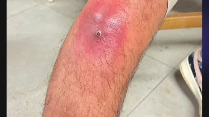 Aranızda sarı kız var mı?