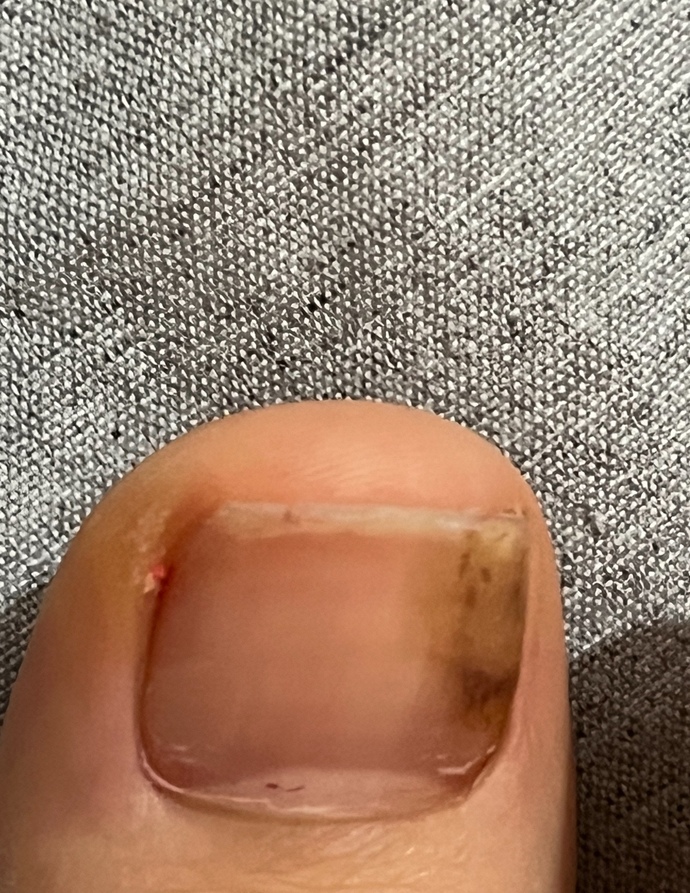 Tırnaklarımda ne oluyor yardımcı olabilir misiniz?