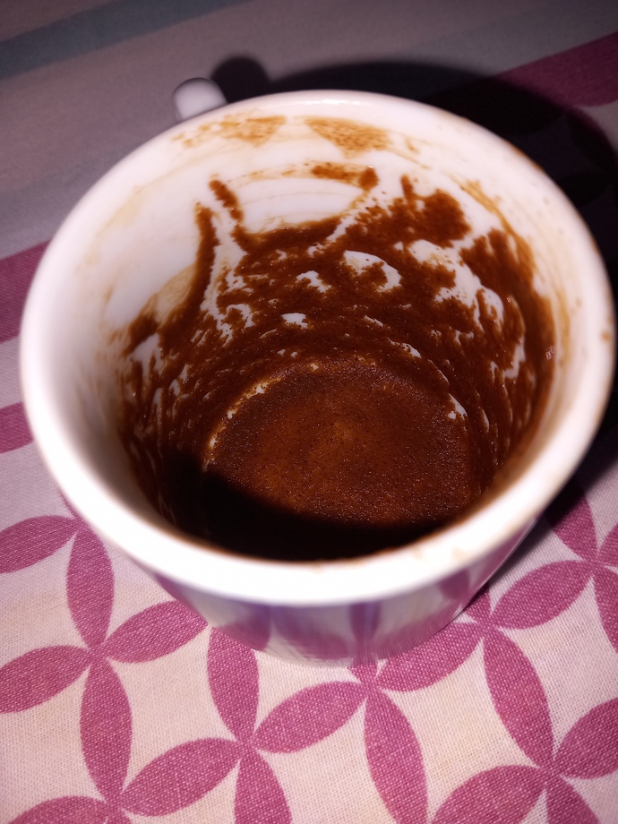 Hissiyati olanlar falima lutfen bakar misiniz?