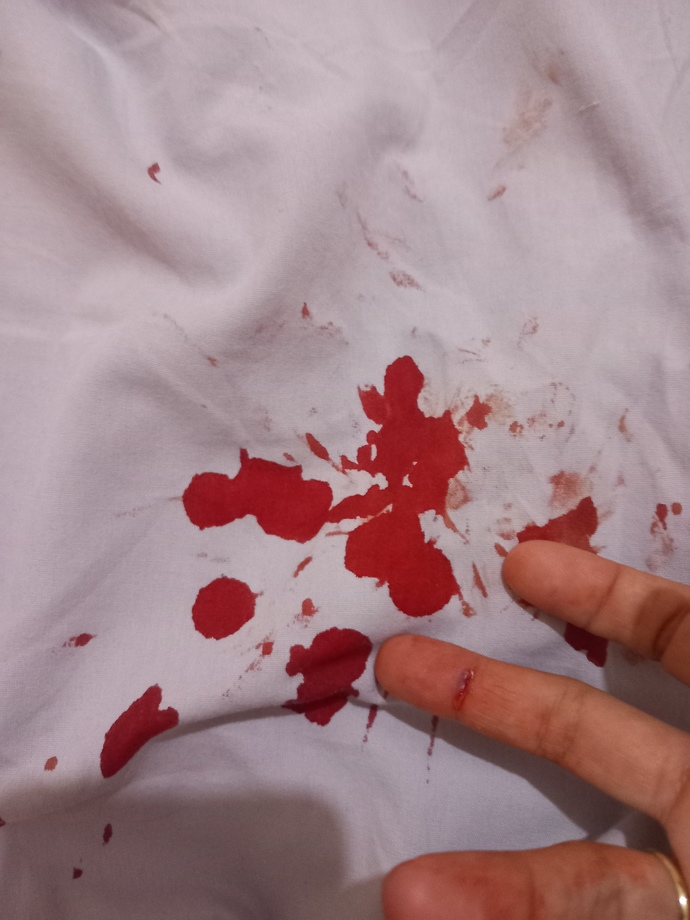 Rüzgar kapıyı parmağımın üstüne kapattı hele bi sor o parmağın orada ne işi vardı?