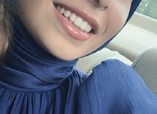 Dişlerinizi göstererek gülmekten çekiniyor musunuz?