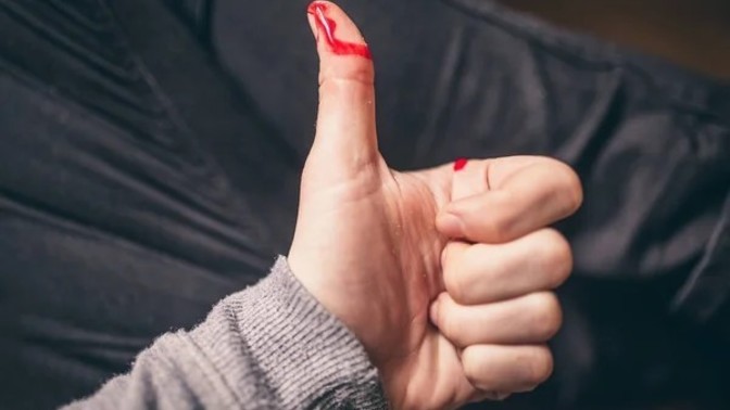 Yemek yaparken başına gelen talihsiz olay neydi?