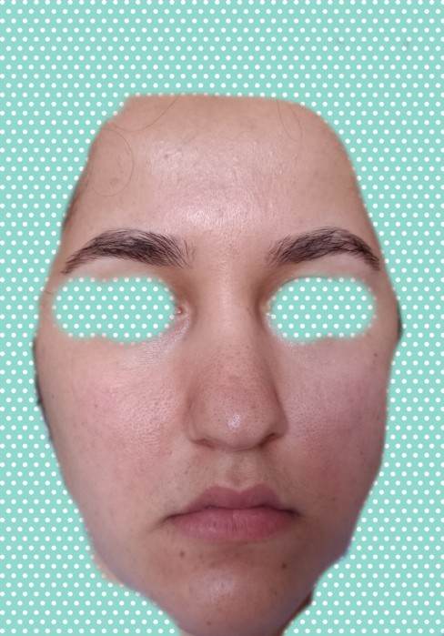 Yüzüm bu hâlde 😔 Biri bana cilt bakımı için neler almam gerektiğini sırayla ve iyi bir marka vererek yardımcı olabilir mi?