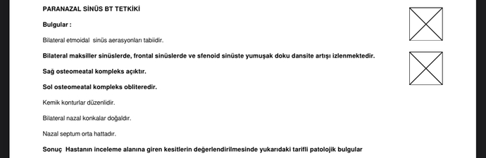 Doktora gittiğimde yanak kemiklerim ve alnım ağrıyor dedim film çekilmen lazım dedi çekildim bu yazıyor BiBilen var mı?