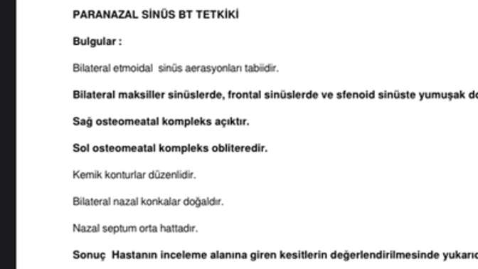 Doktora gittiğimde yanak kemiklerim ve alnım ağrıyor dedim film çekilmen lazım dedi çekildim bu yazıyor Bi'Bilen var mı?