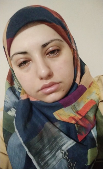 Göz nezlesine ne iyi gelir gözlerim çok kötü oldu sabahtan beri düzelmiyor?