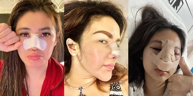 Estetik herkesi güzel yapar mı?