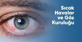 Sıcak havadan Dolayı göz yanması sulanması sizce normal mi yoksa alerjik bir hastalık mıdır?