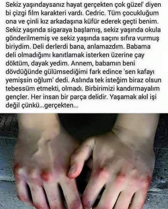Yaşamak nedir sizce akıl işi mi değil mi?