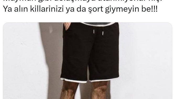 Kıllı erkeklerin şort giymeye hakkı yokmu🙄?