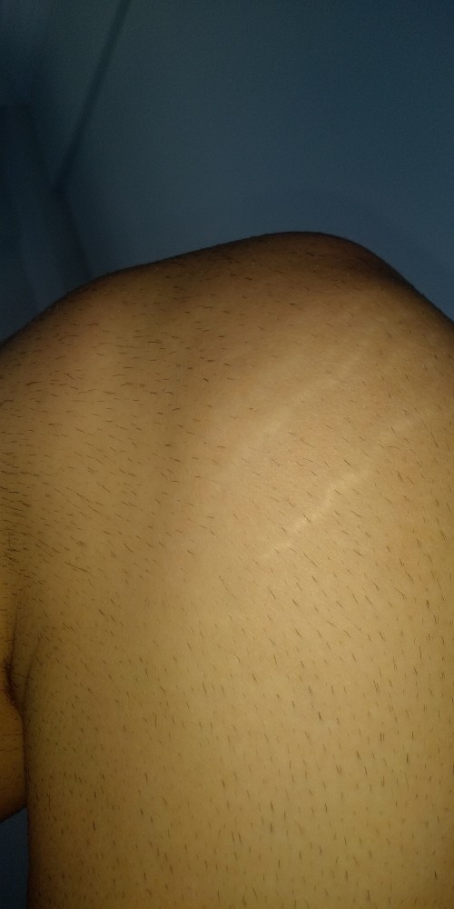 Diz kapağımdaki bu çatlakların nedeni nedir?
