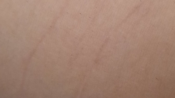 Barfiks çekiyorum kollarımda yırtılmalar oldu bu geliştiğini mi gösterir?