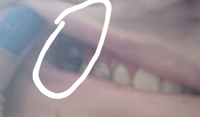 Arkadaslar öncelikle böyle bi resim için özür dilerim ama benim sorunum süt dışım çıkmamış küçüklükten beri orada kalmış?