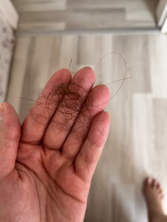 Duştan sonra saçlarım bu kadar dökülüyor normal mi, anormal mi?
