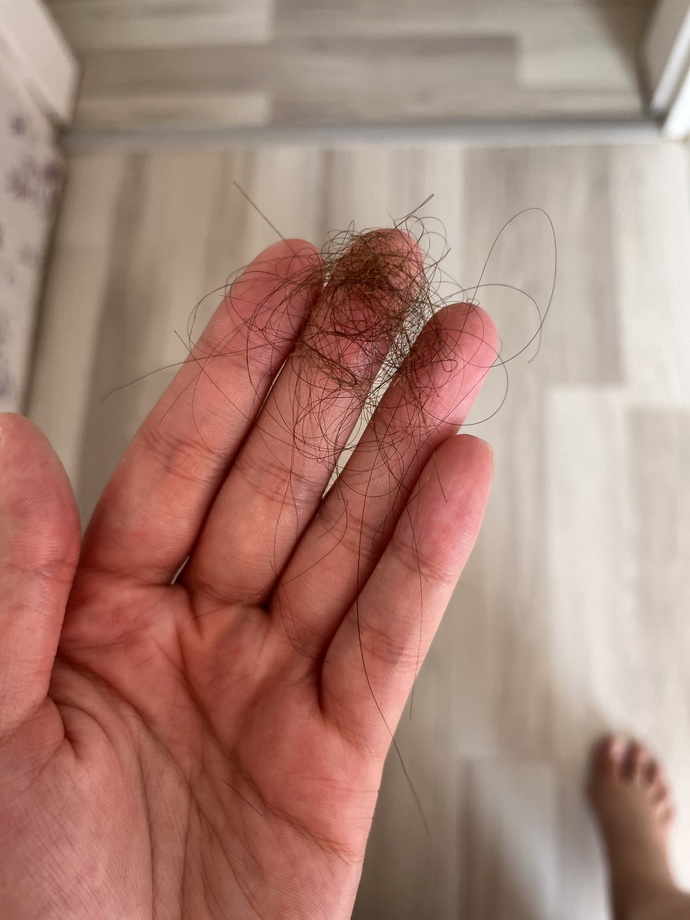 Duştan sonra saçlarım bu kadar dökülüyor normal mi, anormal mi?