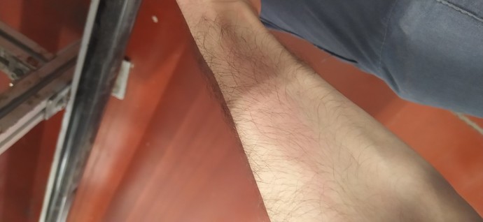 5 yıldır vucudumun he ryerinde kaşıntı var çaresi var mı ?
