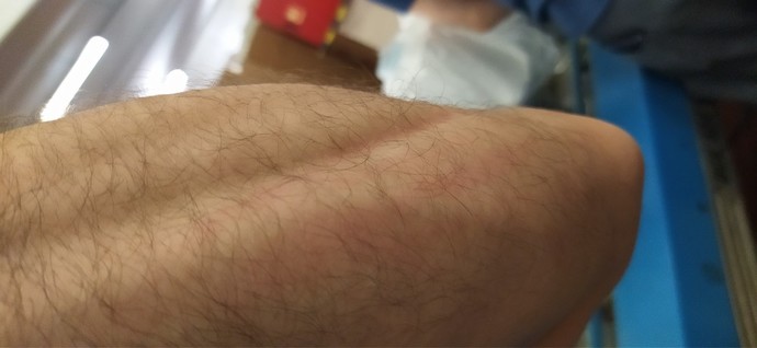 5 yıldır vucudumun he ryerinde kaşıntı var çaresi var mı ?