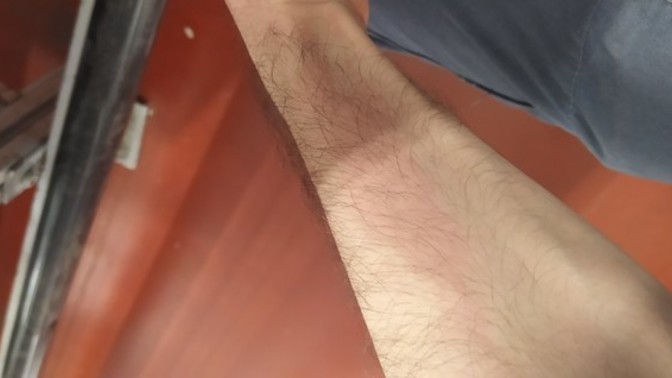 5 yıldır vucudumun he ryerinde kaşıntı var çaresi var mı ?