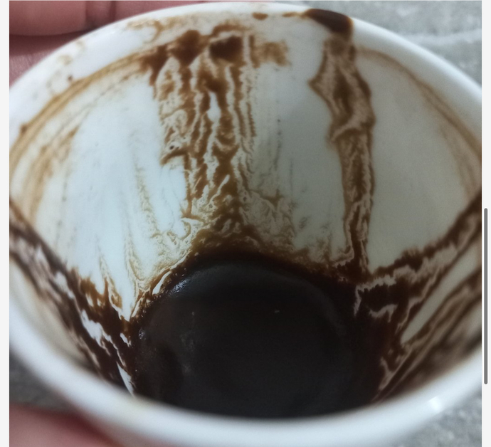 Ask hayatimla bakar mısınız canlaaar eig xper?