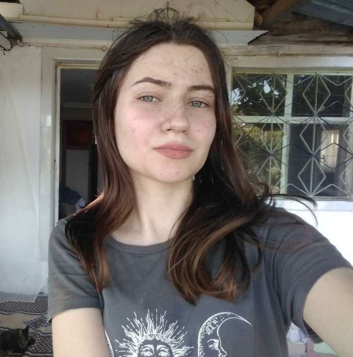 Sivilcelerimin gitmesi için önerileriniz var mı?